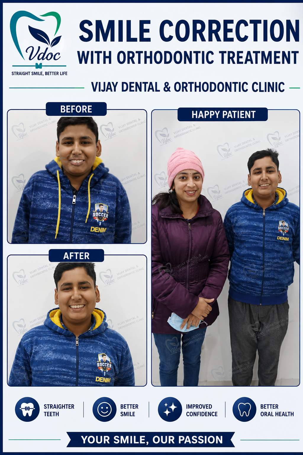 Young smile correction with Orthodontic treatment at Vijay Dental & Orthodontic Clinic